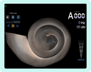 tinnitograma-aplicado-1024x811